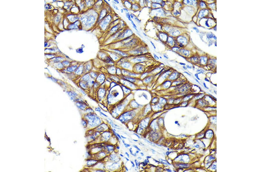 Immunohistochemistry - Anti-CD46 Antibody [ARC0428] (A307262) - Antibodies.com