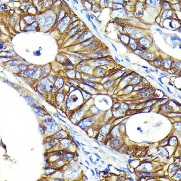 Immunohistochemistry - Anti-CD46 Antibody [ARC0428] (A307262) - Antibodies.com