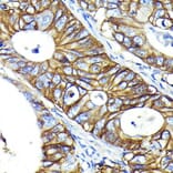 Immunohistochemistry - Anti-CD46 Antibody [ARC0428] (A307262) - Antibodies.com