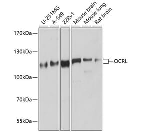 Western Blot - Anti-OCRL Antibody (A307263) - Antibodies.com