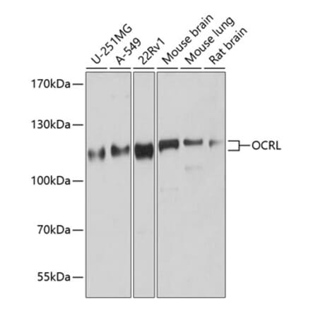 Western Blot - Anti-OCRL Antibody (A307263) - Antibodies.com