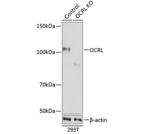 Western Blot - Anti-OCRL Antibody (A307264) - Antibodies.com