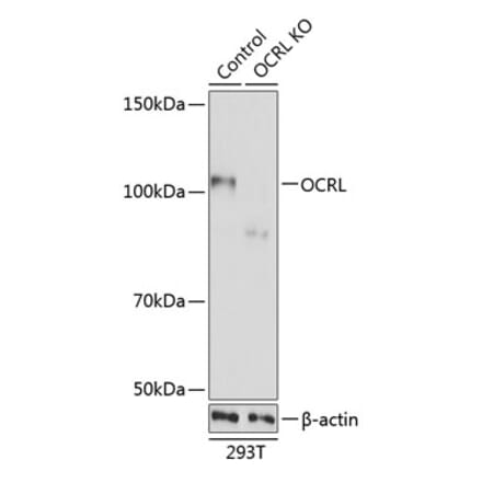 Western Blot - Anti-OCRL Antibody (A307264) - Antibodies.com