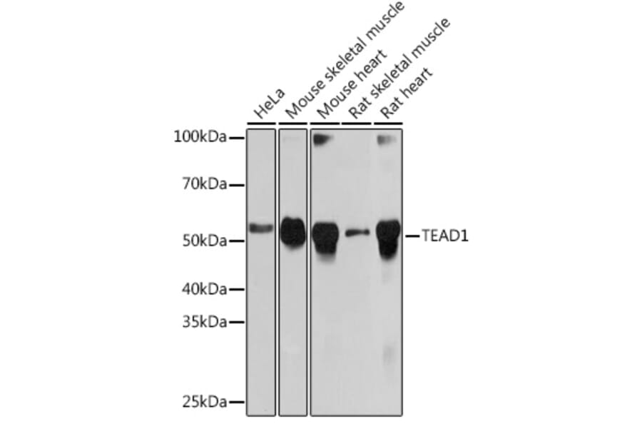 Western Blot - Anti-TEF1/TEAD-1 Antibody [ARC1157] (A307265) - Antibodies.com