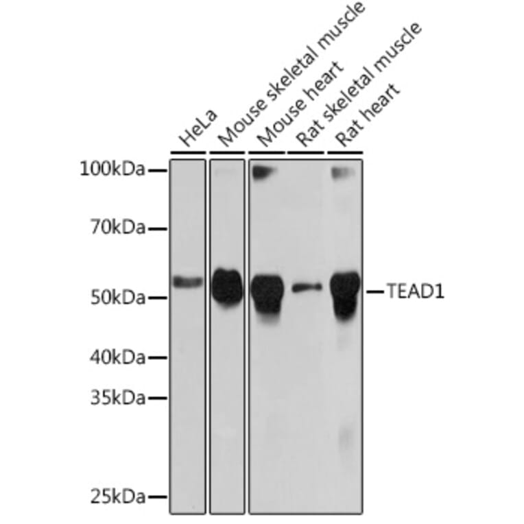 Western Blot - Anti-TEF1/TEAD-1 Antibody [ARC1157] (A307265) - Antibodies.com