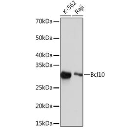 Western Blot - Anti-Bcl10 Antibody [ARC2673] (A307266) - Antibodies.com