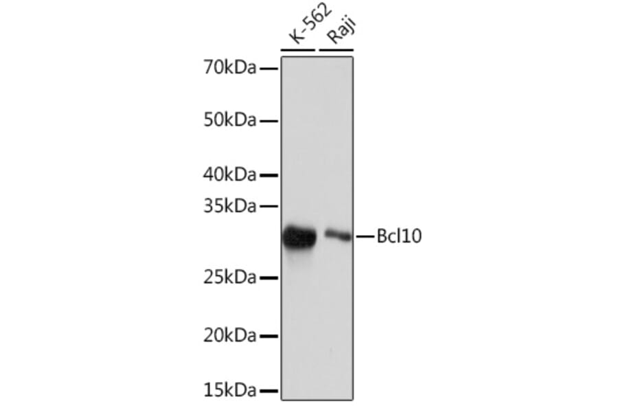 Western Blot - Anti-Bcl10 Antibody [ARC2673] (A307266) - Antibodies.com