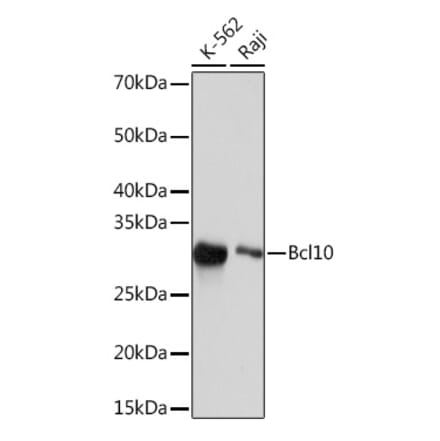 Western Blot - Anti-Bcl10 Antibody [ARC2673] (A307266) - Antibodies.com