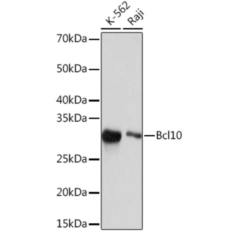 Western Blot - Anti-Bcl10 Antibody [ARC2673] (A307266) - Antibodies.com