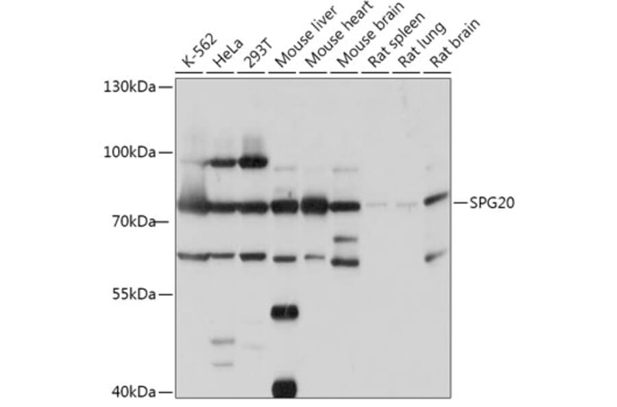 Western Blot - Anti-SPART Antibody (A307268) - Antibodies.com