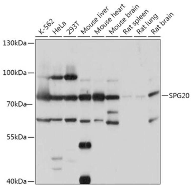 Western Blot - Anti-SPART Antibody (A307268) - Antibodies.com