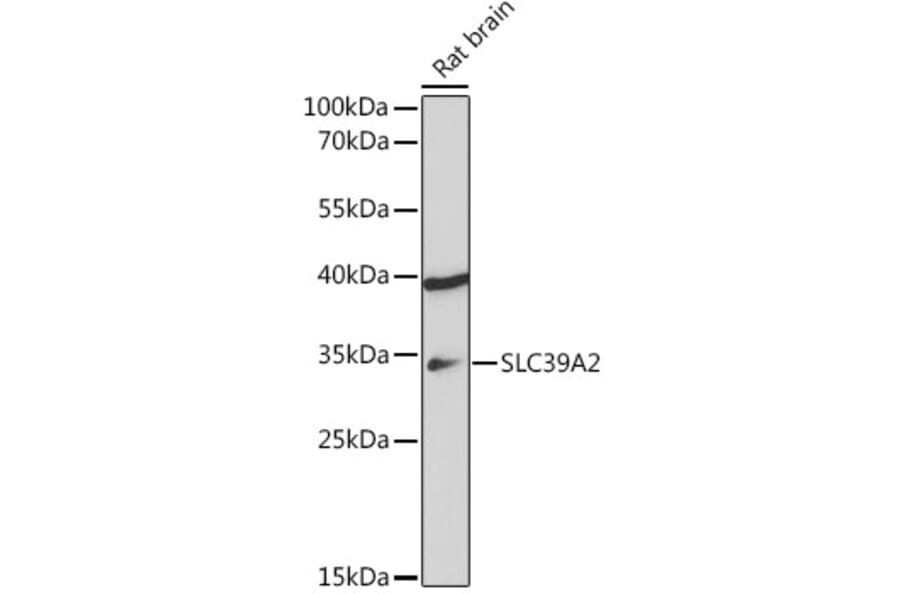 Western Blot - Anti-ZIP2 Antibody (A307269) - Antibodies.com