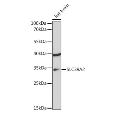 Western Blot - Anti-ZIP2 Antibody (A307269) - Antibodies.com