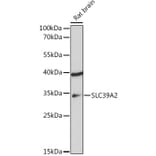 Western Blot - Anti-ZIP2 Antibody (A307269) - Antibodies.com
