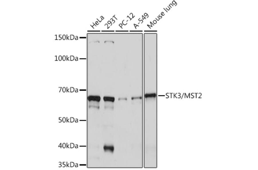 Western Blot - Anti-STK3/MST-2 Antibody [ARC1389] (A307270) - Antibodies.com
