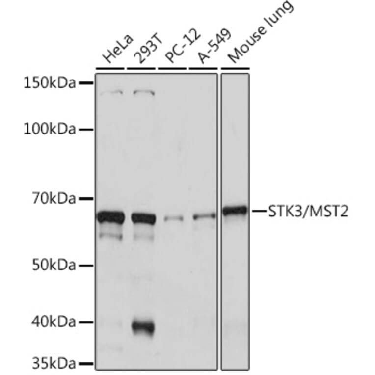 Western Blot - Anti-STK3/MST-2 Antibody [ARC1389] (A307270) - Antibodies.com