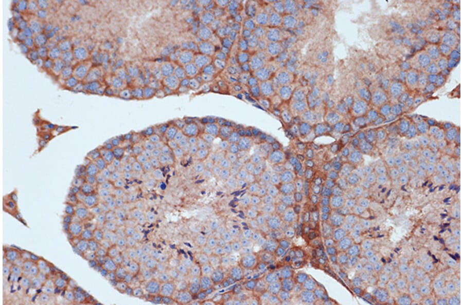 Immunohistochemistry - Anti-STK3/MST-2 Antibody [ARC1389] (A307270) - Antibodies.com