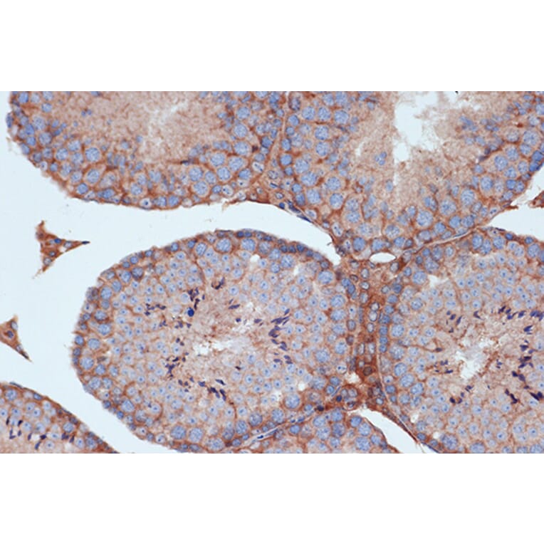 Immunohistochemistry - Anti-STK3/MST-2 Antibody [ARC1389] (A307270) - Antibodies.com