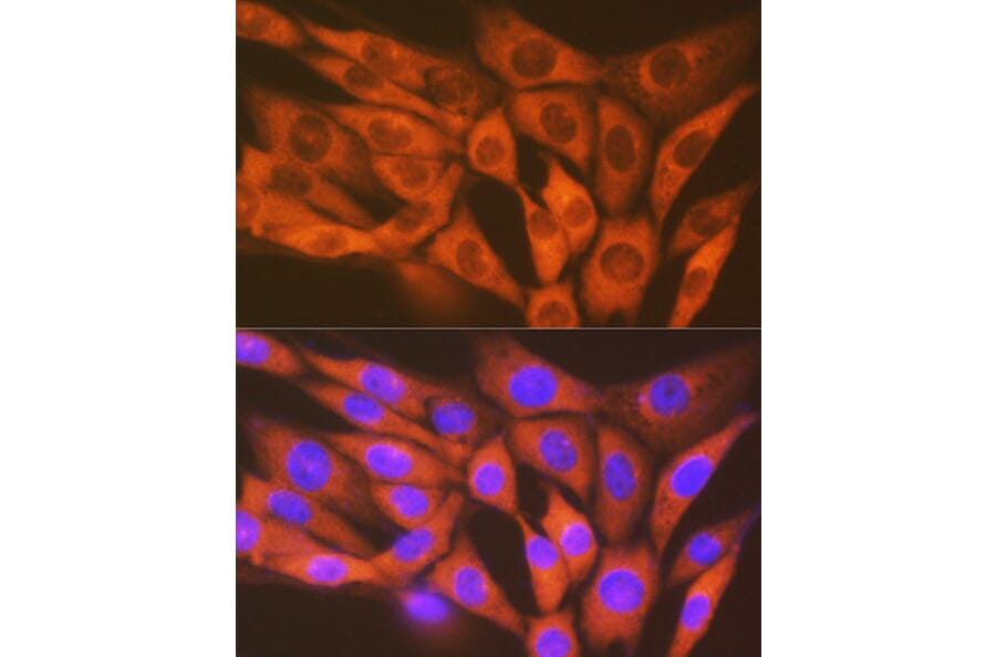 Immunofluorescence - Anti-STK3/MST-2 Antibody [ARC1389] (A307270) - Antibodies.com