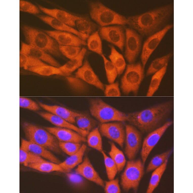 Immunofluorescence - Anti-STK3/MST-2 Antibody [ARC1389] (A307270) - Antibodies.com