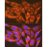 Immunofluorescence - Anti-STK3/MST-2 Antibody [ARC1389] (A307270) - Antibodies.com