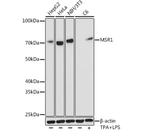 Western Blot - Anti-CD204 Antibody [ARC0750] (A307271) - Antibodies.com