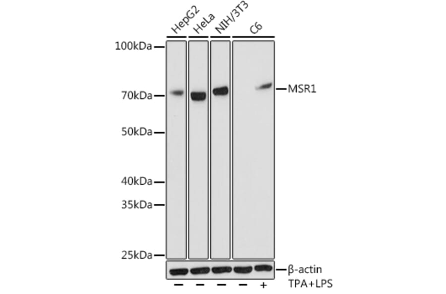 Western Blot - Anti-CD204 Antibody [ARC0750] (A307271) - Antibodies.com