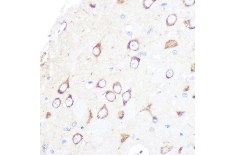 Immunohistochemistry - Anti-CD204 Antibody [ARC0750] (A307271) - Antibodies.com