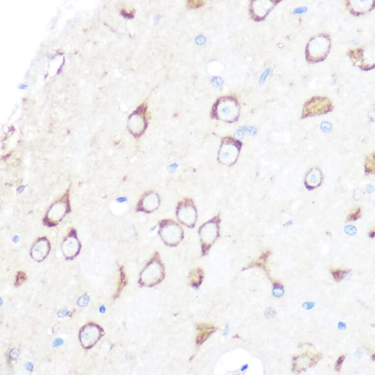 Immunohistochemistry - Anti-CD204 Antibody [ARC0750] (A307271) - Antibodies.com