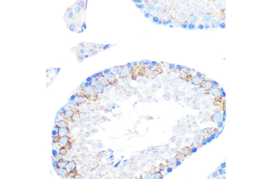 Immunohistochemistry - Anti-CD204 Antibody [ARC0750] (A307271) - Antibodies.com