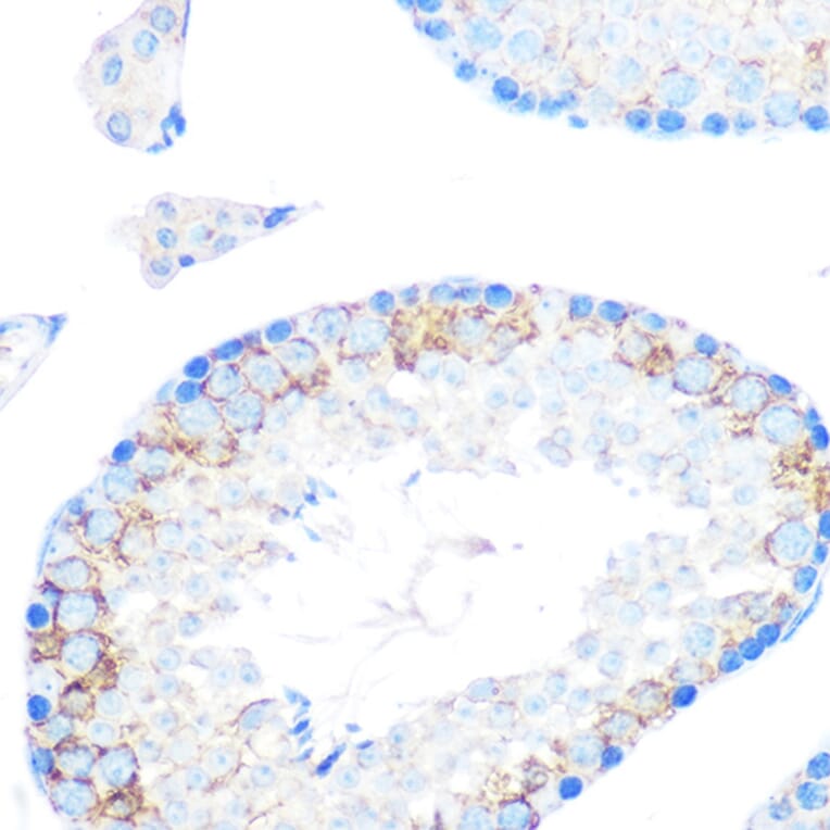 Immunohistochemistry - Anti-CD204 Antibody [ARC0750] (A307271) - Antibodies.com