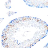 Immunohistochemistry - Anti-CD204 Antibody [ARC0750] (A307271) - Antibodies.com