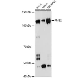 Western Blot - Anti-PMS2 Antibody [ARC1039] (A307272) - Antibodies.com