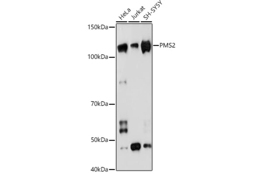 Western Blot - Anti-PMS2 Antibody [ARC1039] (A307272) - Antibodies.com