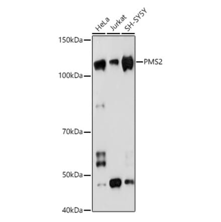 Western Blot - Anti-PMS2 Antibody [ARC1039] (A307272) - Antibodies.com
