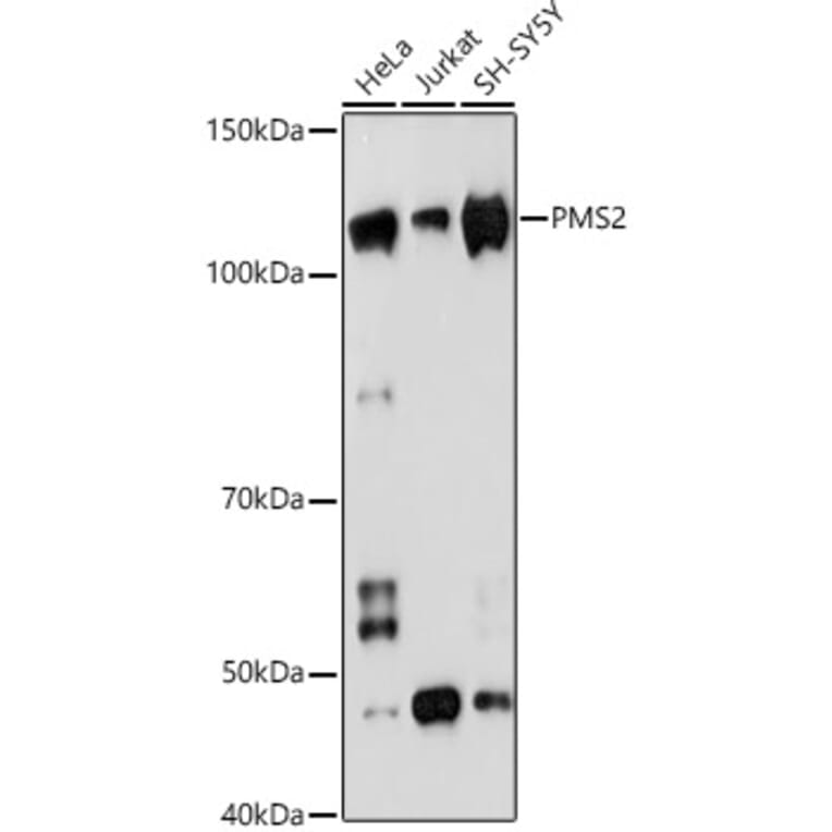Western Blot - Anti-PMS2 Antibody [ARC1039] (A307272) - Antibodies.com