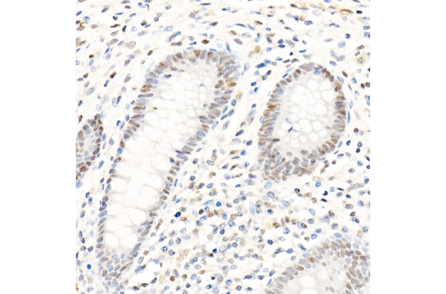 Immunohistochemistry - Anti-PMS2 Antibody [ARC1039] (A307272) - Antibodies.com