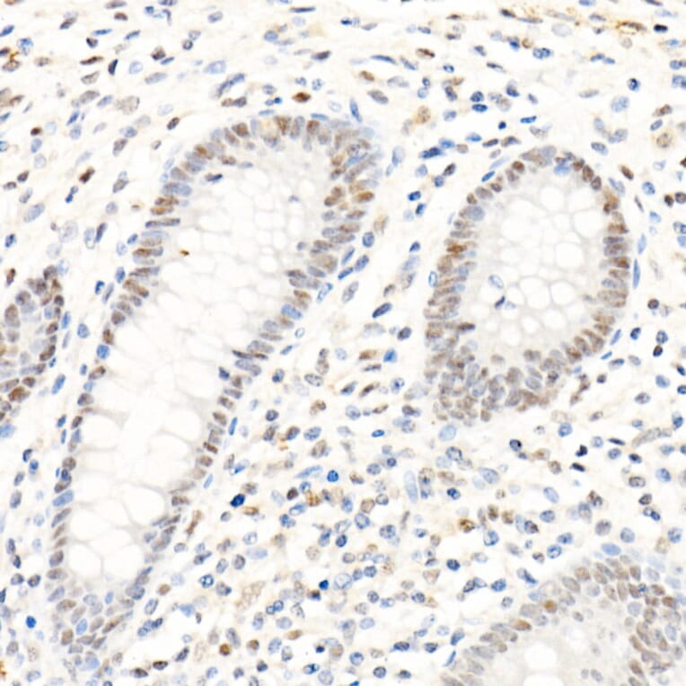 Immunohistochemistry - Anti-PMS2 Antibody [ARC1039] (A307272) - Antibodies.com