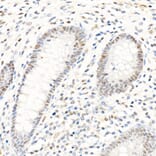 Immunohistochemistry - Anti-PMS2 Antibody [ARC1039] (A307272) - Antibodies.com