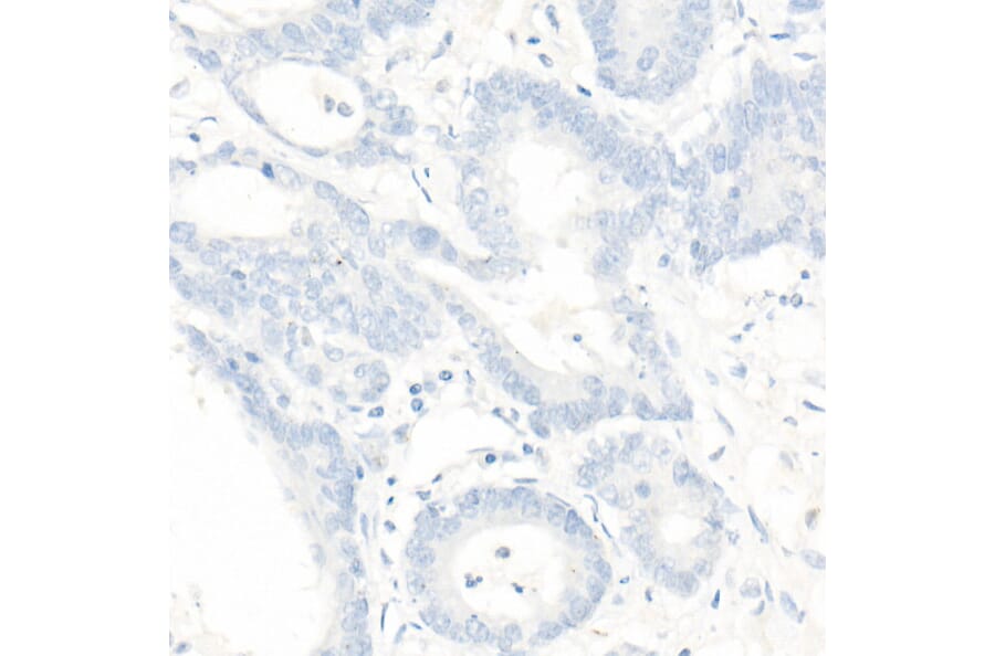 Immunohistochemistry - Anti-PMS2 Antibody [ARC1039] (A307272) - Antibodies.com