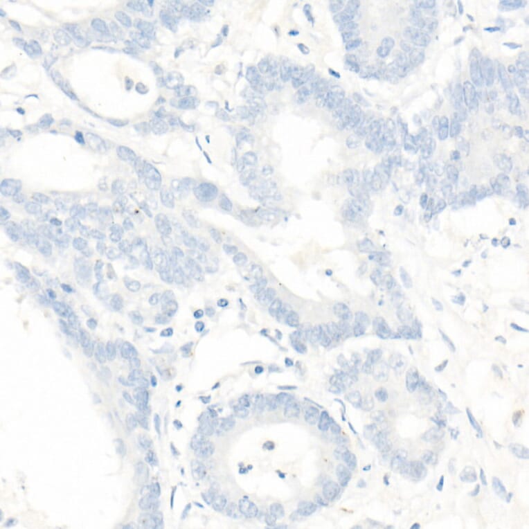 Immunohistochemistry - Anti-PMS2 Antibody [ARC1039] (A307272) - Antibodies.com