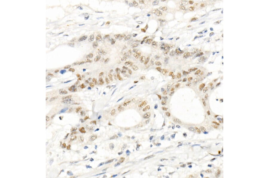 Immunohistochemistry - Anti-PMS2 Antibody [ARC1039] (A307272) - Antibodies.com