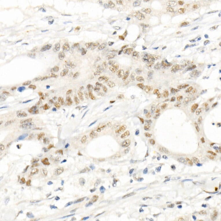 Immunohistochemistry - Anti-PMS2 Antibody [ARC1039] (A307272) - Antibodies.com