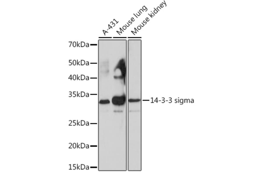 Western Blot - Anti-14-3-3 sigma/SFN Antibody [ARC0988] (A307274) - Antibodies.com