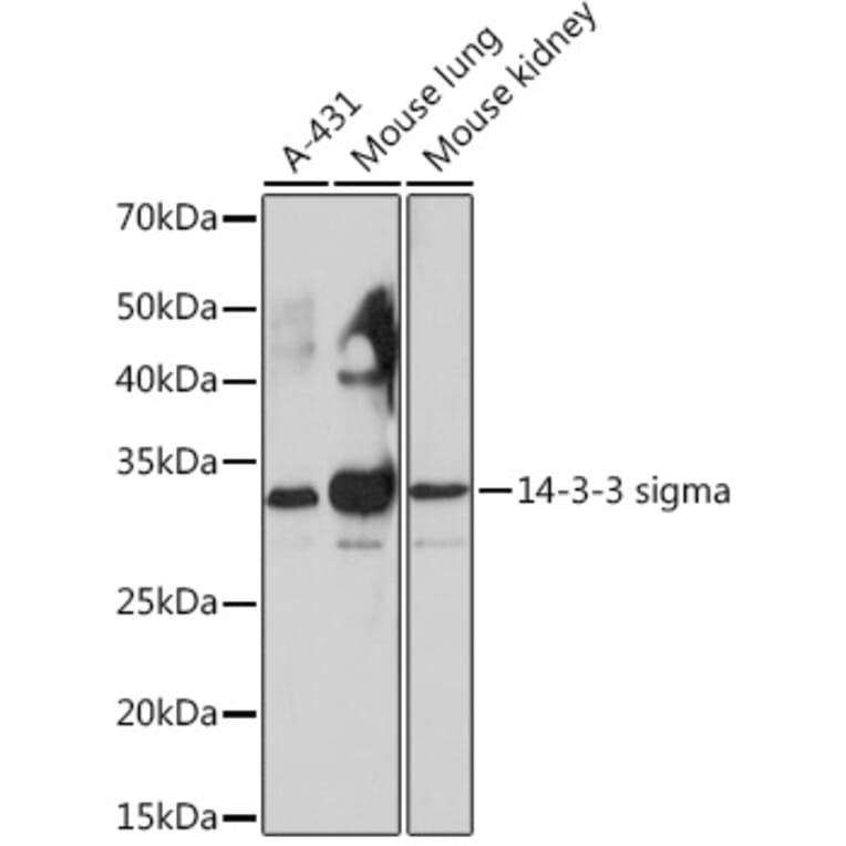 Western Blot - Anti-14-3-3 sigma/SFN Antibody [ARC0988] (A307274) - Antibodies.com
