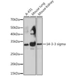 Western Blot - Anti-14-3-3 sigma/SFN Antibody [ARC0988] (A307274) - Antibodies.com