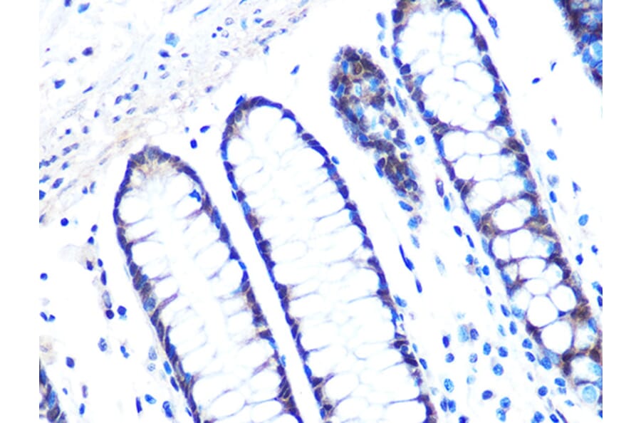 Immunohistochemistry - Anti-14-3-3 sigma/SFN Antibody [ARC0988] (A307274) - Antibodies.com