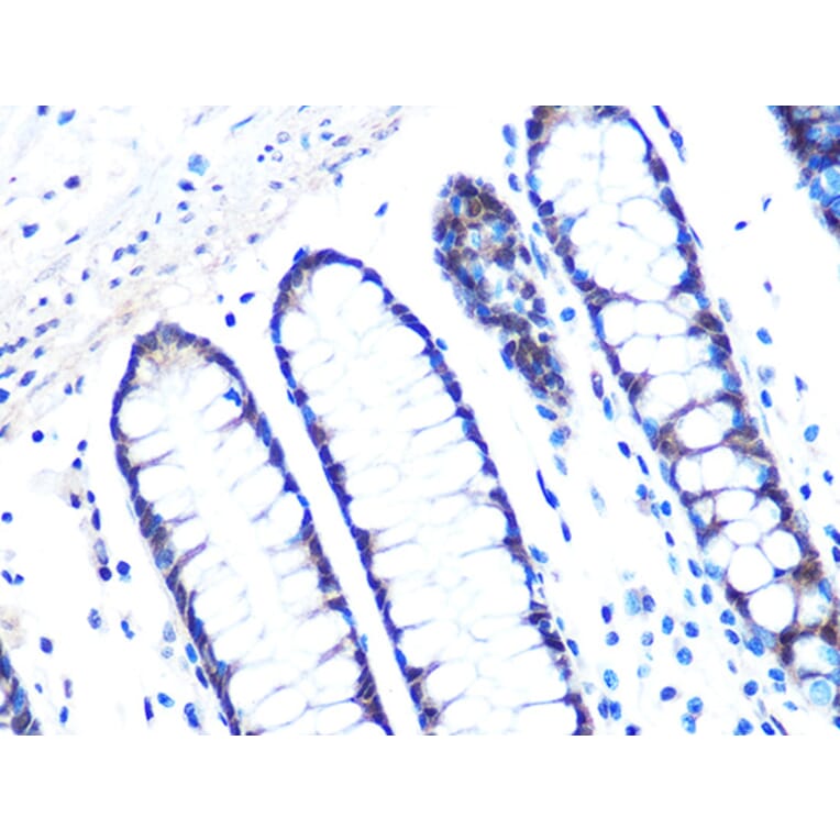 Immunohistochemistry - Anti-14-3-3 sigma/SFN Antibody [ARC0988] (A307274) - Antibodies.com