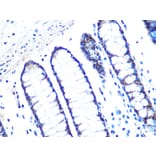 Immunohistochemistry - Anti-14-3-3 sigma/SFN Antibody [ARC0988] (A307274) - Antibodies.com