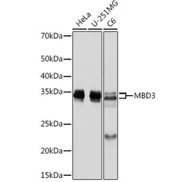 Western Blot - Anti-MBD3 Antibody [ARC2466] (A307276) - Antibodies.com